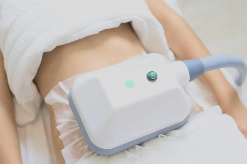 How Fat Freezing and HIFU Work Together? 3 advantages to combining Fat Freezing and HIFU Isle of Isla