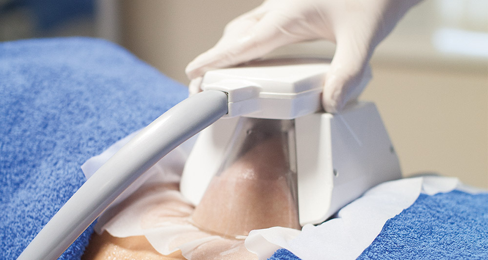 How Fat Freezing and HIFU Work Together? 2 Multiple Areas in One Session HIFU and Fat Freezing Isle of Isla
