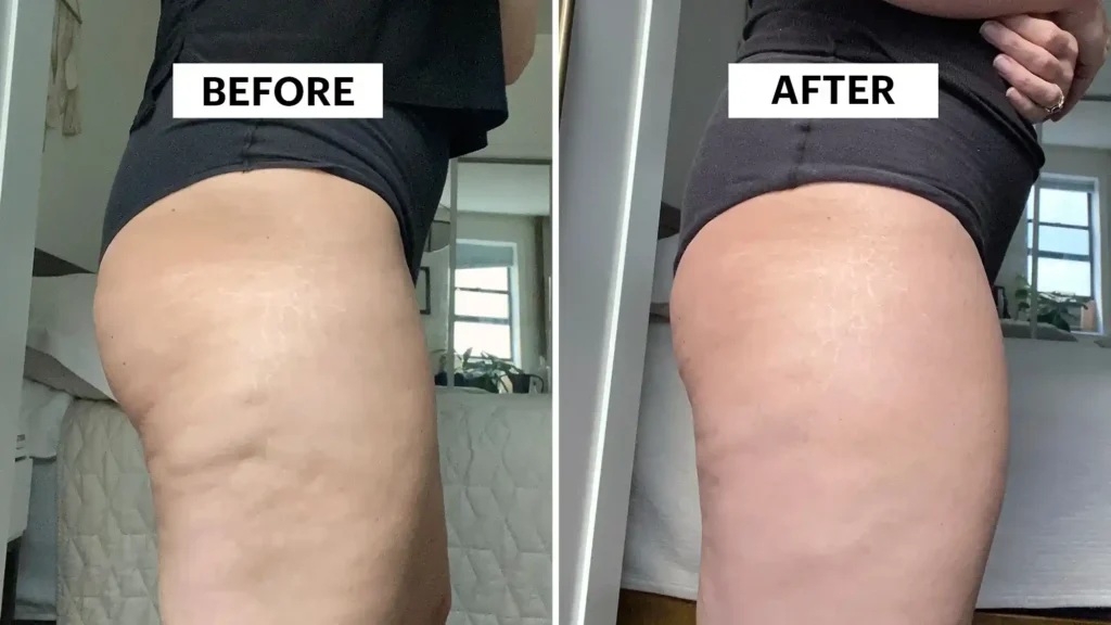 Sculpting Your Bum: Can Toning Exercises Really Reduce Cellulite? 1 Do Toning Exercise Isle of Isla Really Tackle Cellulite?