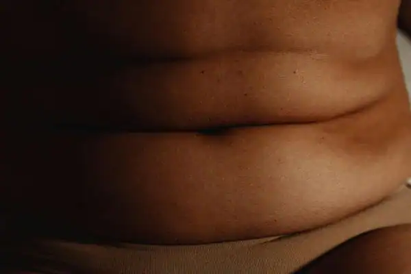 The Hidden Connection: How Stress Shapes Your Fitness and Body Composition 3 image of what stress can do on the stomach area and how Lipo 360 Isle of Isla can help to change your body shape.
